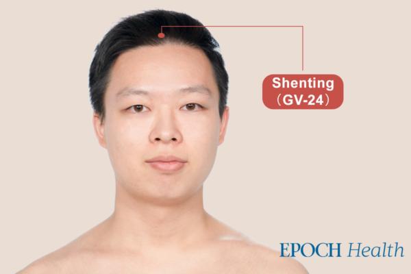 Hair-nourishing acupoint on the scalp, Shenting (GV 24). (The Epoch Times)
