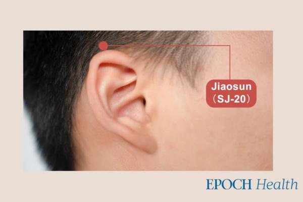 Hair-nourishing acupoint on the scalp, Shenting Jiaosun (SJ 20). (The Epoch Times)