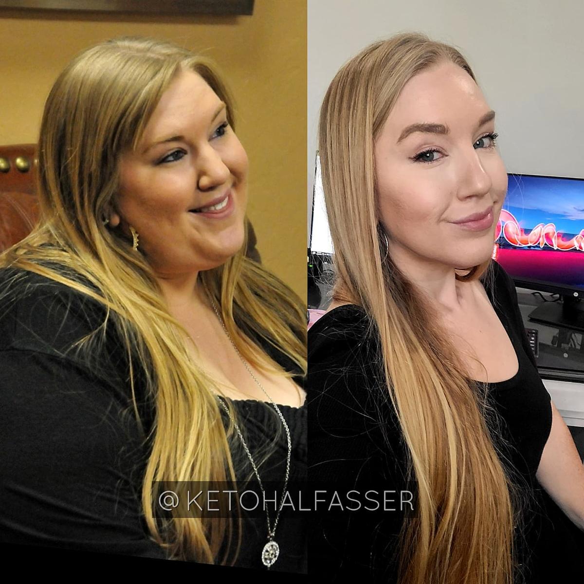 (Left) Ms. Bishop before her weight loss journey began. (Right) Ms. Bishop after her transformation journey began. (Courtesy of <a href="https://www.instagram.com/ketohalfasser/">Chelsey Bishop</a>)