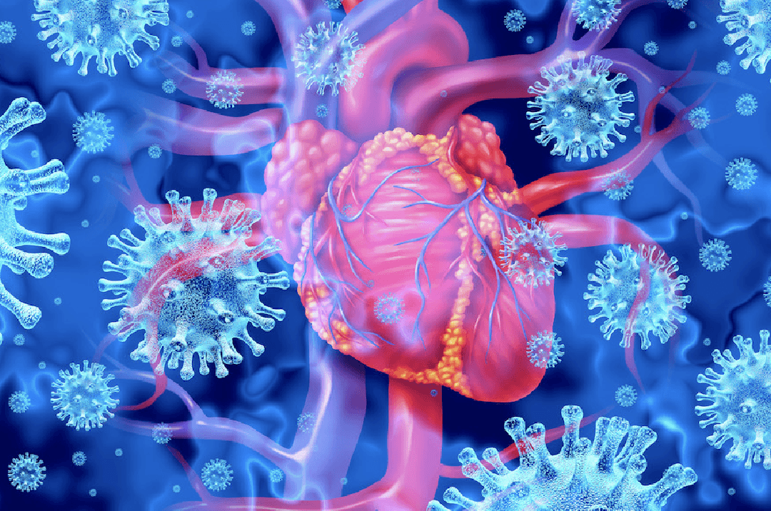 Myocarditis Caused by COVID-19 Vaccine Spike Protein Is Often Not Detected by Typical Cardiac Tests