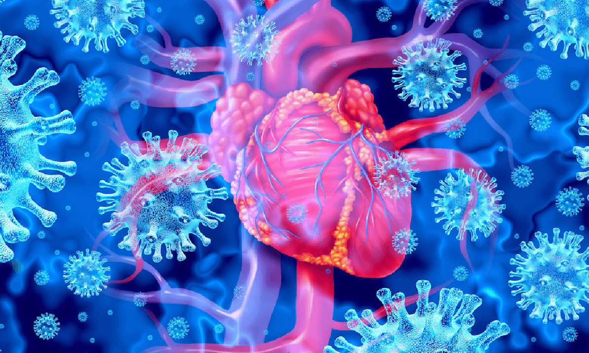 Myocarditis Caused by COVID-19 Vaccine Spike Protein Is Often Not Detected by Typical Cardiac Tests