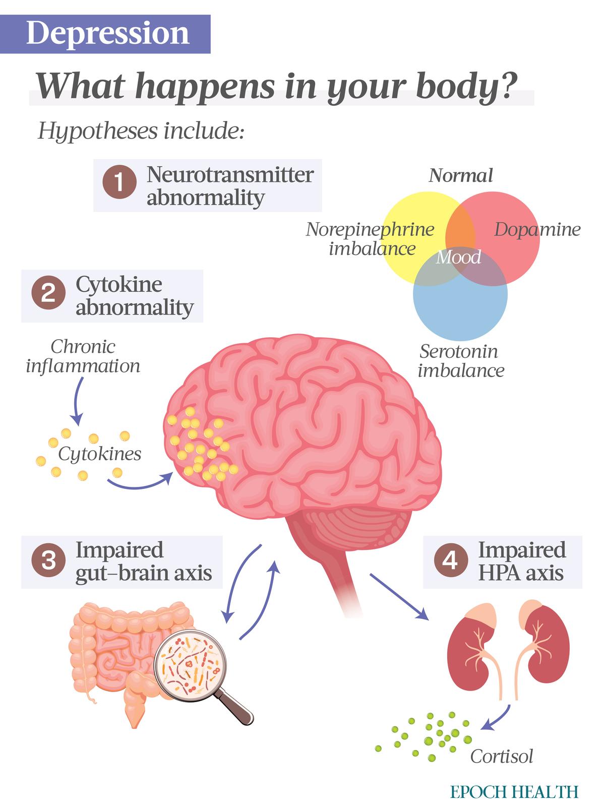Depression is most likely caused by a combination of factors that include environmental, chemical, and genetic factors. These are four hypotheses theorizing what biological mechanisms are involved in depression. (The Epoch Times)