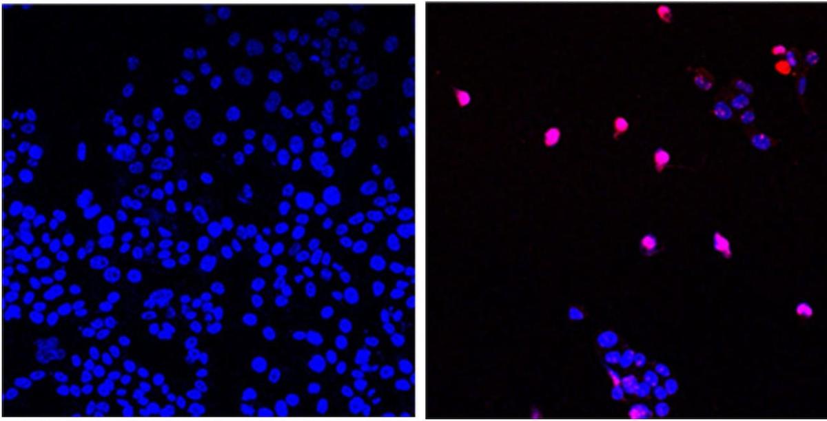 US Scientists Develop New ‘Cancer-Stopping Pill’ That Can ‘Annihilate’ Tumors, Leave Healthy Cells Unharmed