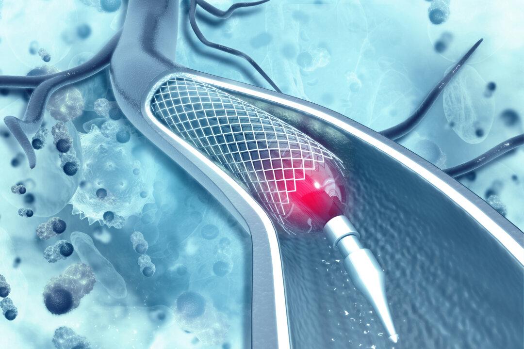 Angioplasty Heart Stent Risks Versus Benefits