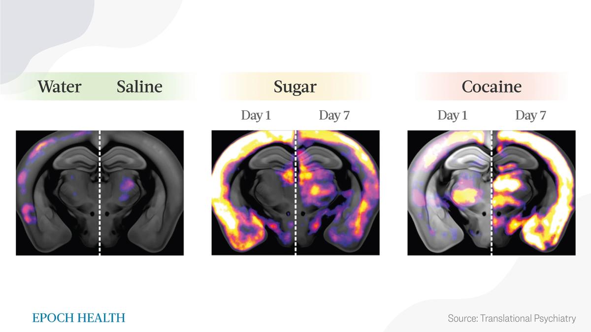 Activation of brain neurons in specific regions upon sucrose and cocaine administration. (The Epoch Times)