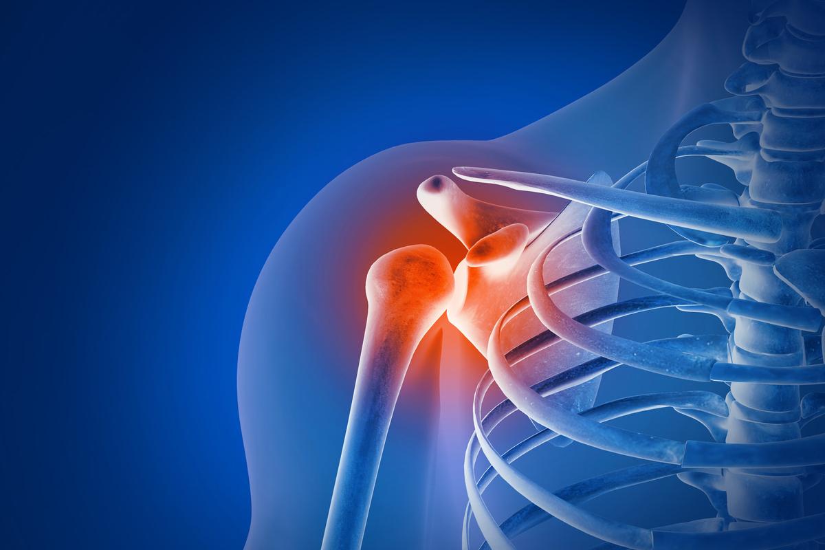 Chronic Shoulder Pain: Often Caused by Muscular Imbalances, 5 Exercises to Restore Movement, Strength, and Balance