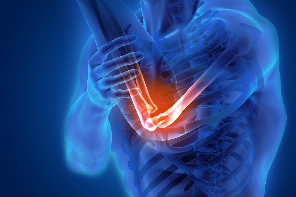 Chronic Elbow Pain: Often Caused by Muscle Weakness, 6 Easy Exercises to Relieve