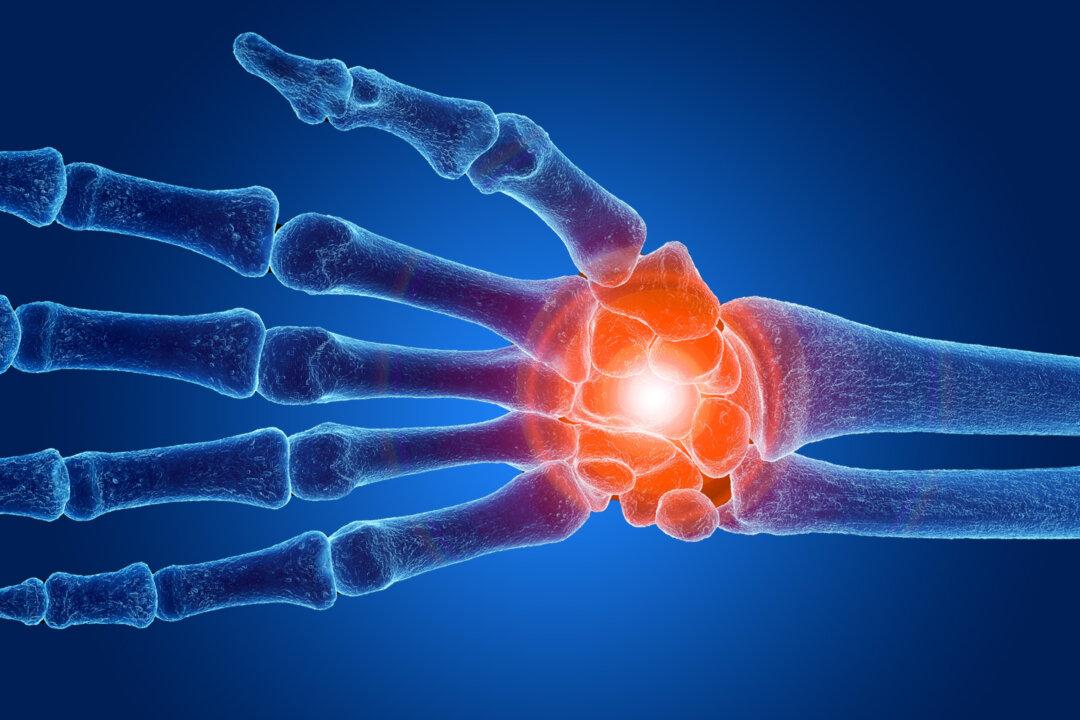 Chronic Wrist Pain: Can Last for Years, a Therapist’s Top Exercises to Relieve