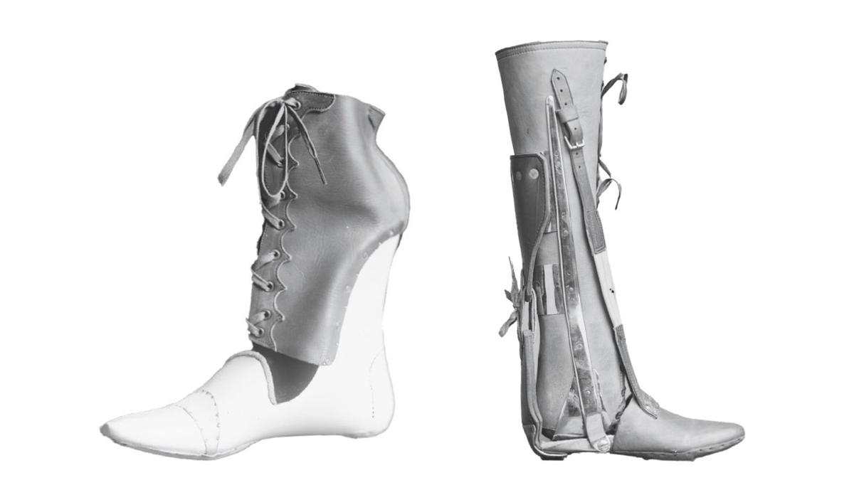 How a Crippled Civil War Vet Invented Prosthetics and Gave the Wounded a Second Chance at Life