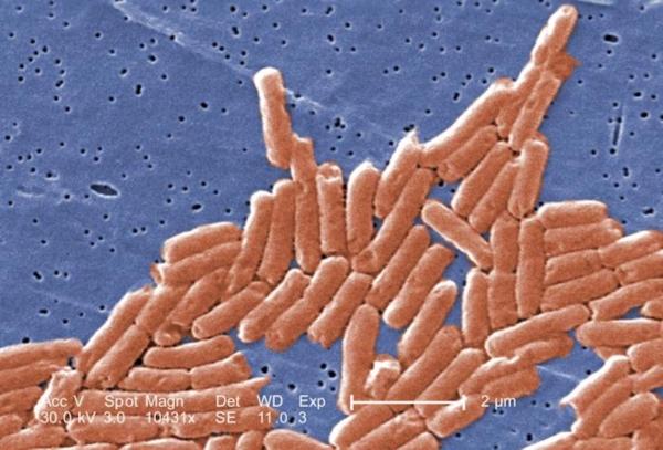 Salmonella Outbreak: CDC Warns Americans to Avoid Malichita, Rudy Branded Cantaloupes
