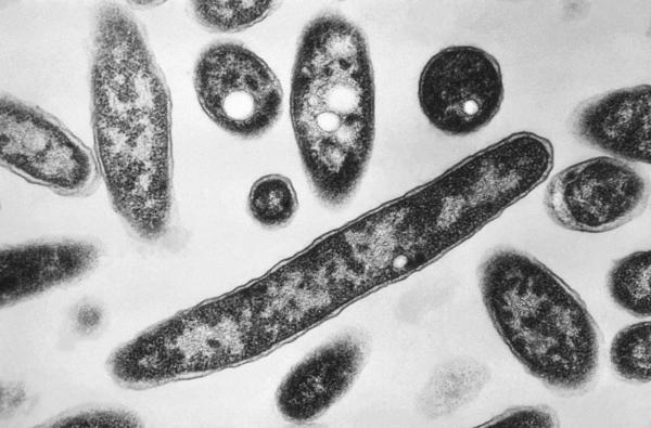 Legionella pneumophila bacteria, which are responsible for causing the pneumonic disease Legionnaires' disease in a 1978 electron microscope image. (Francis Chandler/CDC via AP)