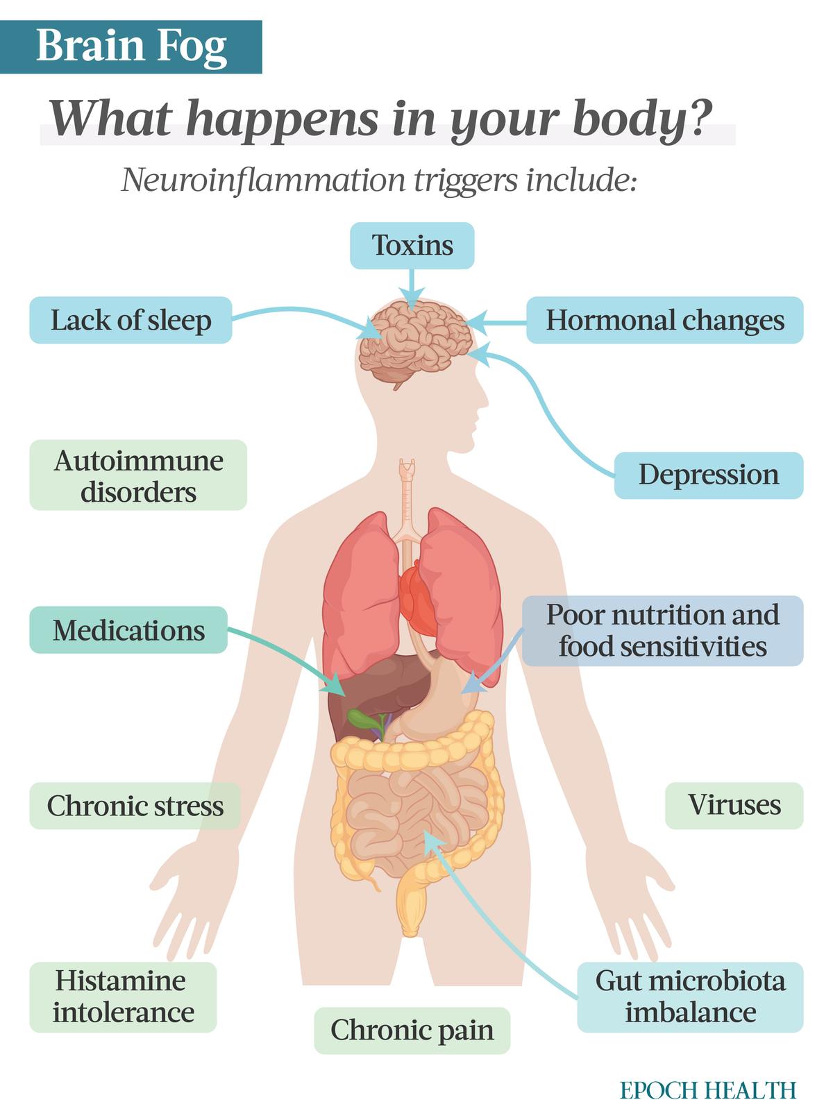 While the exact cause of brain fog is unknown, inflammation is suspected to be the mechanism behind it. (The Epoch Times)