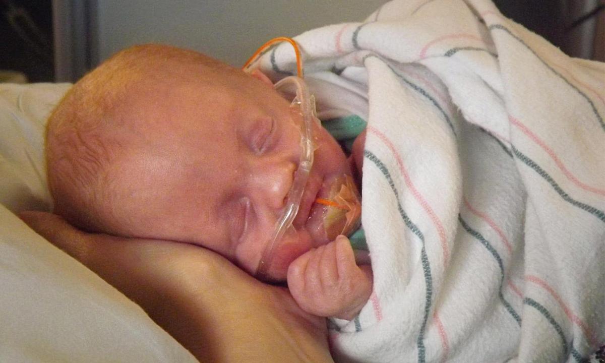 Doctors Call Baby With Trisomy 18 'Incompatible With Life,' Offer Abortion—But She Lives on to Thrive: 'God Doesn't Make Mistakes'