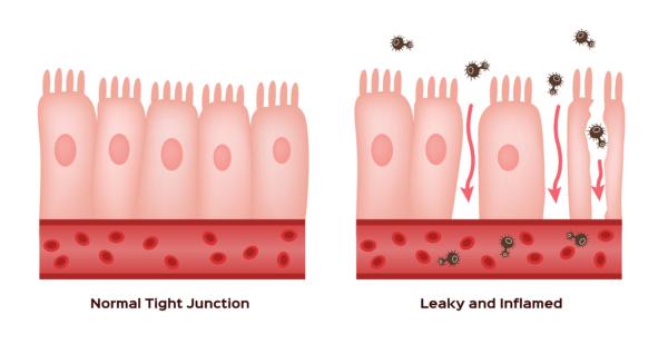 L. reuteri bacteria have the ability to produce mucus that helps intestinal barrier form tight junctions that can better keep pathogens and toxins from entering the blood stream.