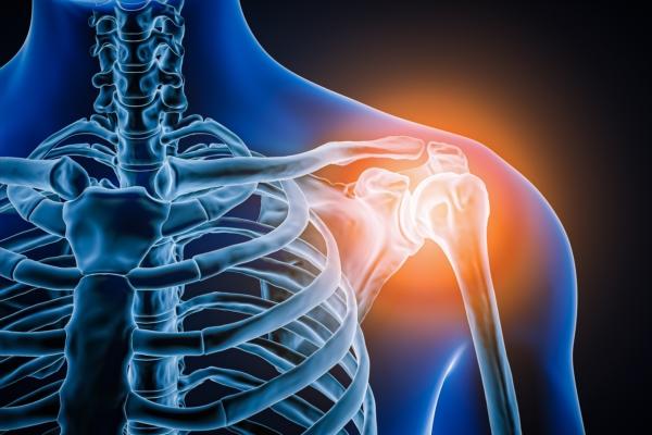 6 Therapist-Recommended Exercises for Frozen Shoulder