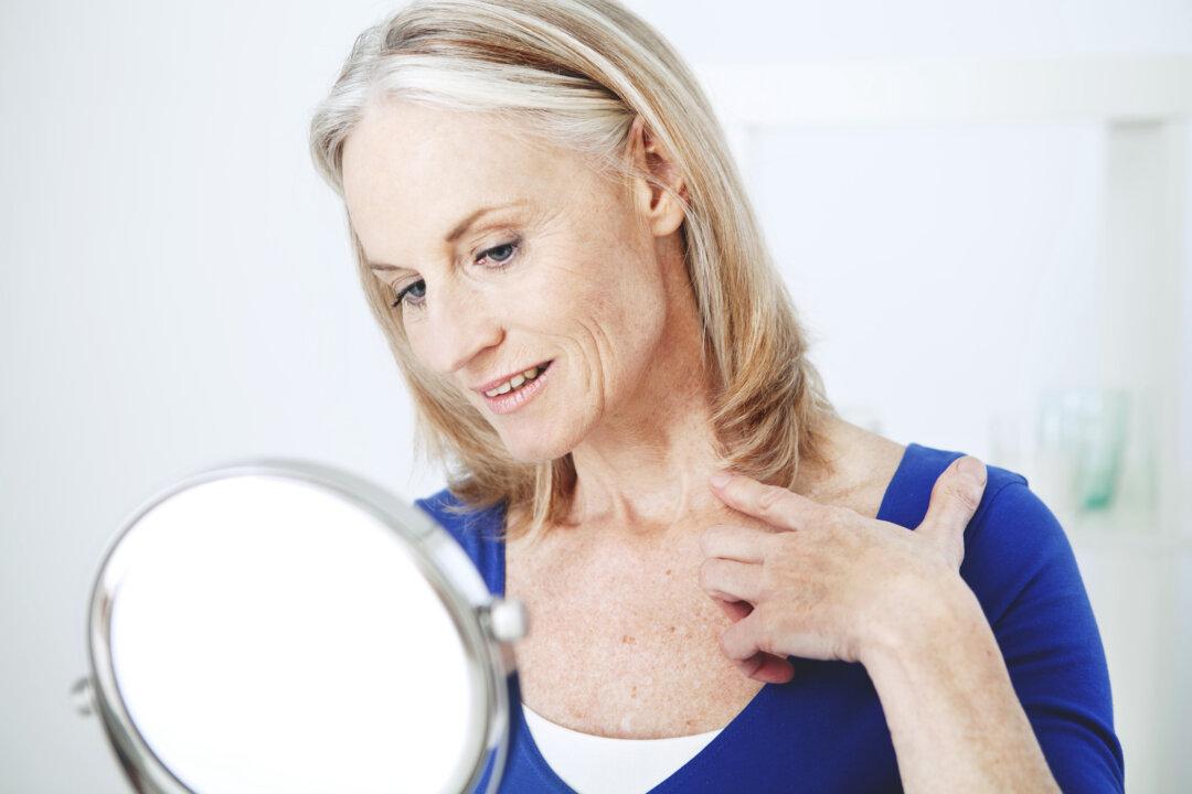Natural Remedies and Prevention for Skin Tags