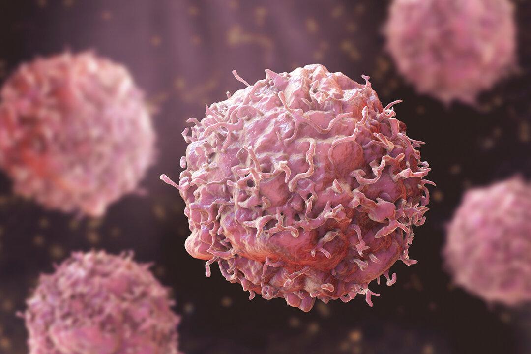 Study Finds Early-Onset Cancers Skyrocketing Globally: A Closer Look