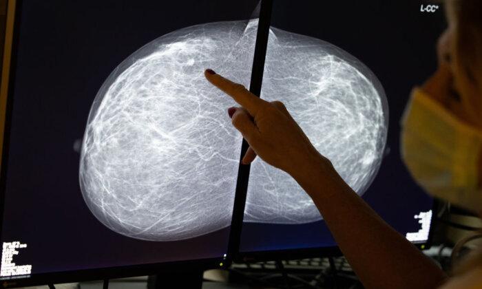 Breast Cancer Cases Climb, Screening Drop Over Pandemic