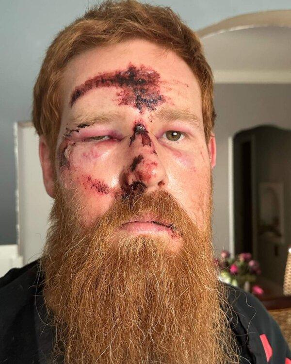 James Briscoe was attacked in his driveway in Cobourg, Ont., on Sept. 22, 2023. (Courtesy of James Briscoe)
