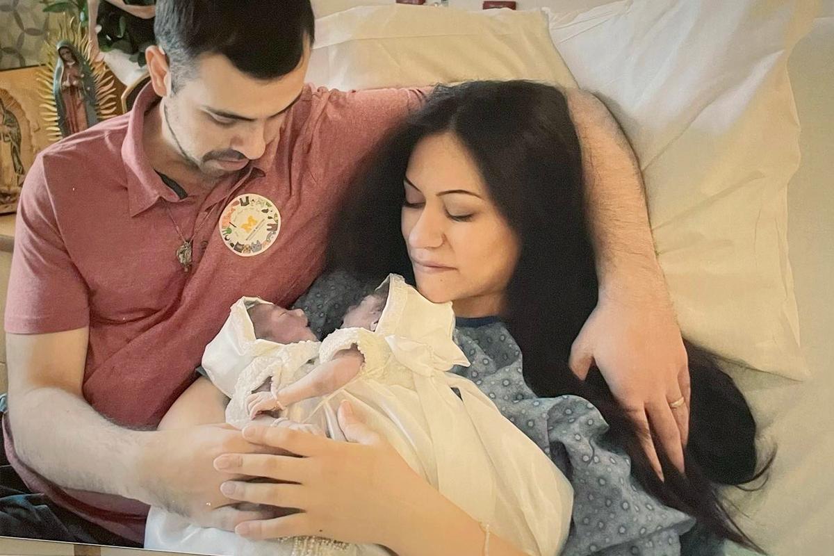 An Hour-Long Gift of Life: Parents Refuse to Abort Conjoined Twins, Baptize Them Before Their Last Breath