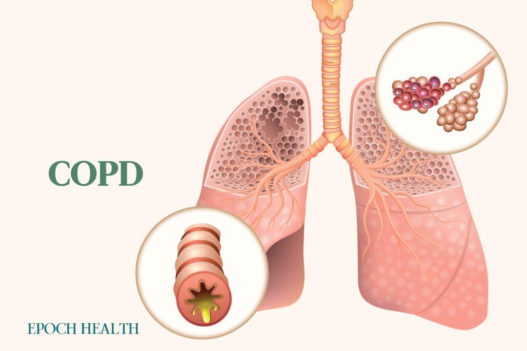 COPD: Symptoms, Causes, Treatments, and Natural Approaches