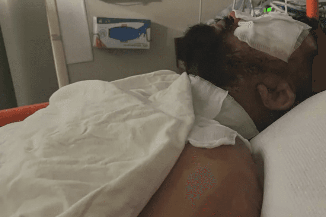 Store Clerk Set on Fire by Alleged Shoplifter in Northern California