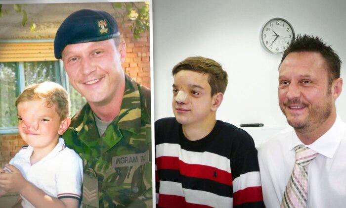 Soldier Got Life-Saving Surgery for Boy With Severe Facial Cleft 20 Years Ago—Look at Him Now
