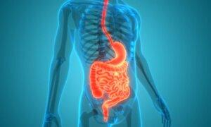 How Sugar Harms Your Gut and Increases Colorectal Cancer Risk