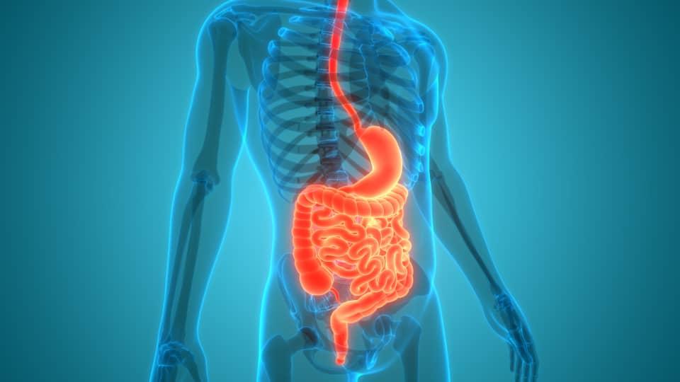 How Sugar Harms Your Gut and Increases Colorectal Cancer Risk