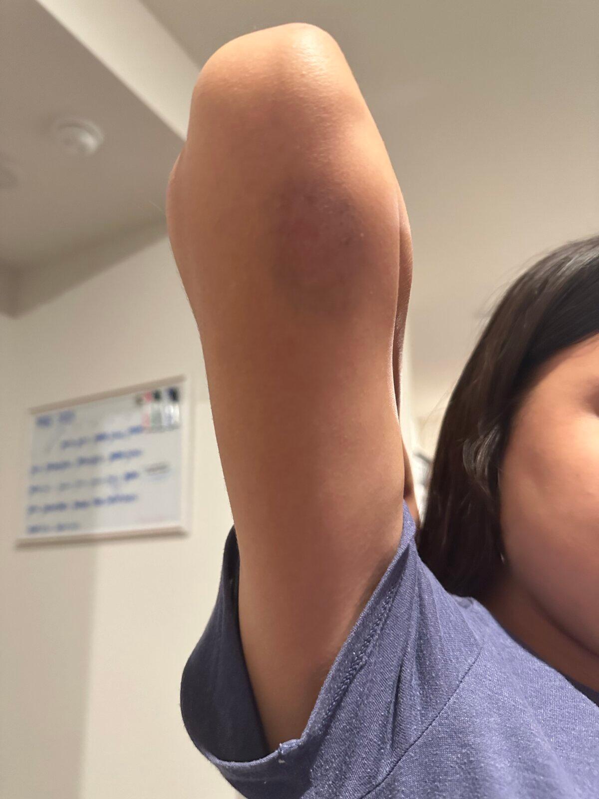 Ashley Duarte said her teen was attacked by four students on a bus in Denton, Texas, on May 16, 2023.