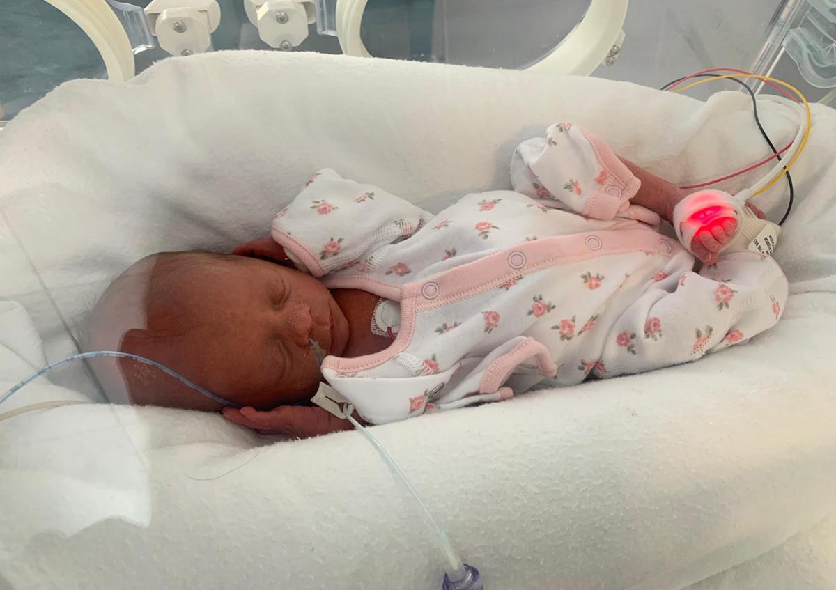 Sienna as a baby in the NICU in 2018. (SWNS)