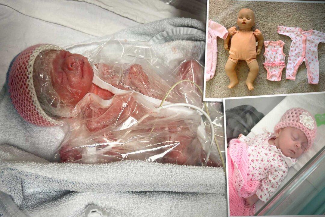 Baby Born 2 Months Early Was So Tiny She Had to Wear Doll’s Clothes—But Now She’s Thriving