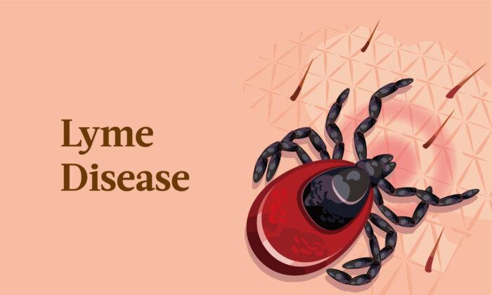 Lyme Disease: Symptoms, Causes, Treatments, and Natural Approaches