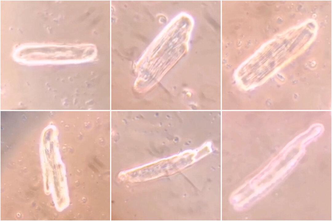 mRNA COVID Vaccines Form Spike Protein in Heart Cells, but Cause Different Anomalies: Research Article