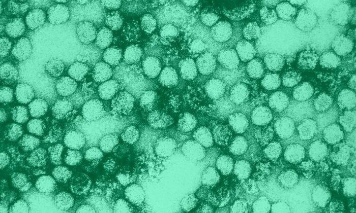 Long-Forgotten Virus Could Return, US Is Not Prepared: Researchers