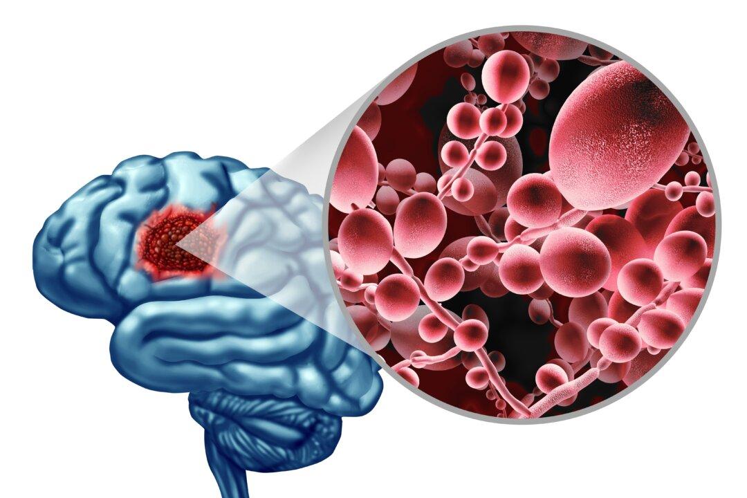 Fungal Infection in the Brain Produces Effects Similar to Alzheimer’s