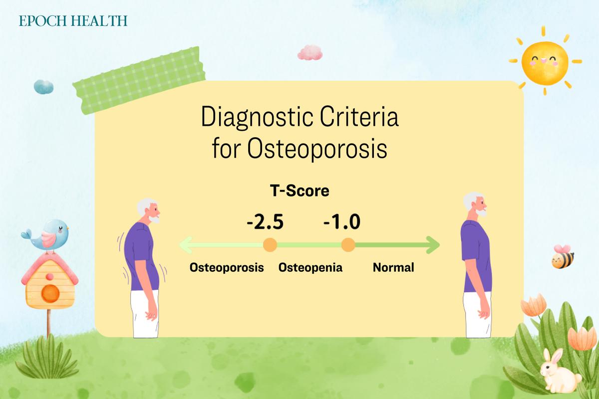 A T-score equal to or less than -2.5 indicates osteoporosis. (The Epoch Times)