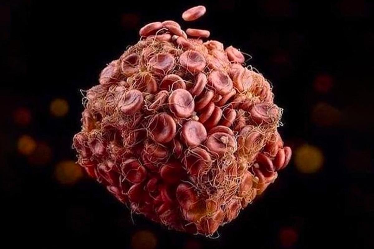 New Research Explains Why Some People Develop Fatal Blood Clots After COVID Vaccination