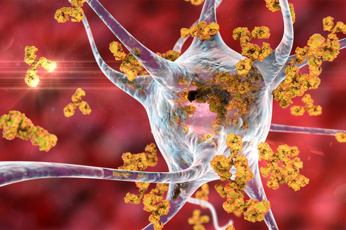 How Sugar May Be Linked to Autoimmune Diseases