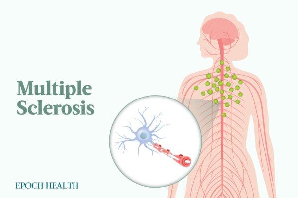 The Essential Guide to Multiple Sclerosis: Symptoms, Causes, Treatments, and Natural Approaches