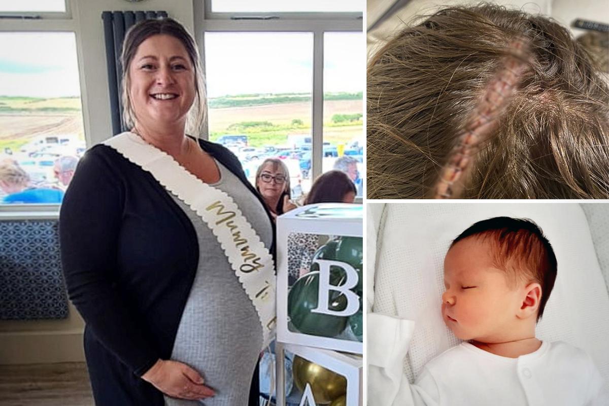 Pregnant Mom Diagnosed With a Brain Tumor at 34 Weeks Says Her Unborn Baby Saved Her Life