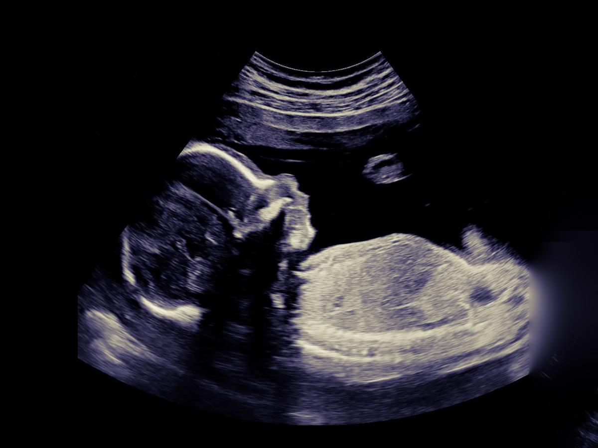 Ms. Duran's ultrasound scan shows the baby she's carrying. (Courtesy of <a href="https://www.instagram.com/msvanessaduran/">@msvanessaduran</a>)