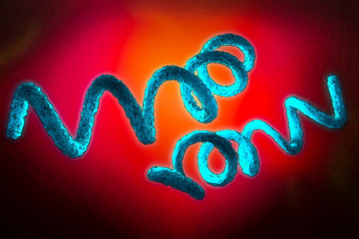 Syphilis and Congenital Syphilis Rise Sharply in the US, Causes Explained