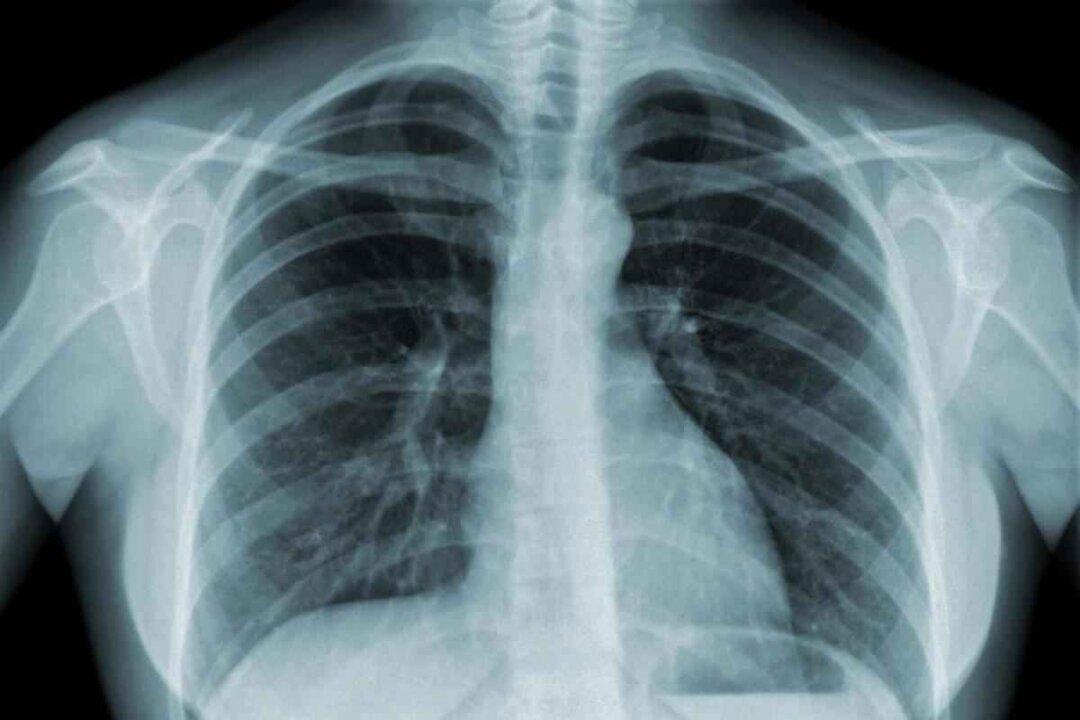 Addressing Chronic Obstructive Pulmonary Disease: The Potential of Korean Herbal Medicine in Cleansing the Lung
