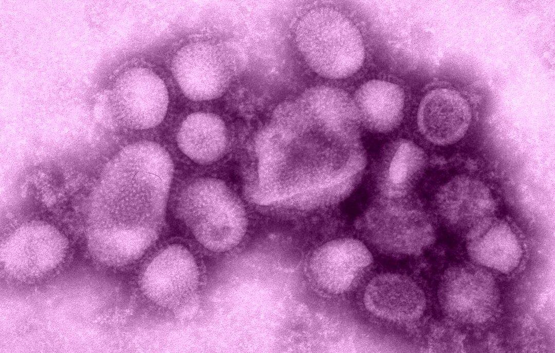 1st Human Case of Swine Flu Variant Detected as Officials Scramble to Find Contacts