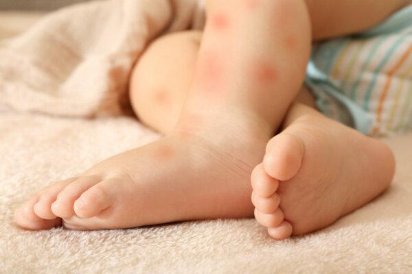 ‘Perfectly Healthy’ 15-Month-Old Girl Dies Two Days After Routine Vaccination | USNN World News (Africa Studio/Shutterstock)