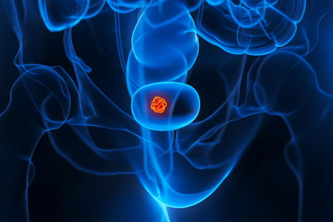 New Treatments Extend Lives of Advanced Bladder Cancer Patients