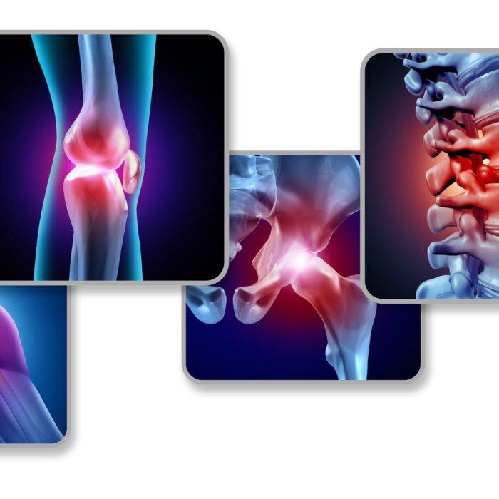 5 Low-Impact Exercises for Psoriatic Arthritis Relief