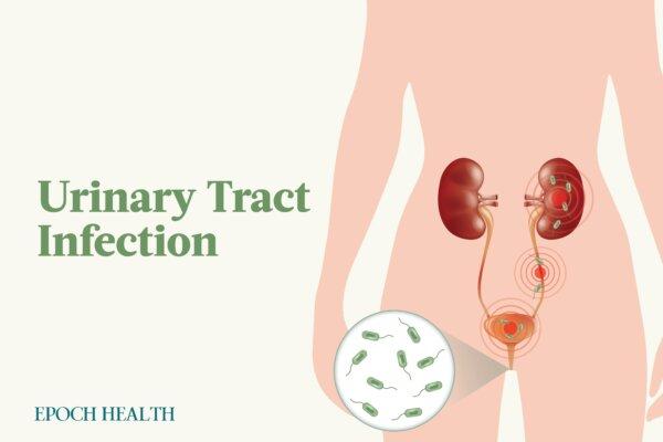 The Essential Guide to Urinary Tract Infections: Symptoms, Causes, Treatments, and Natural Approaches