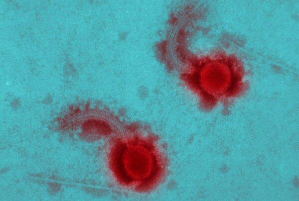Electron micrograph of a bacteriophage. The United States uses bacteriophages, viruses that kill bacteria, in meat processing. (Image Source Trading Ltd/Shutterstock)